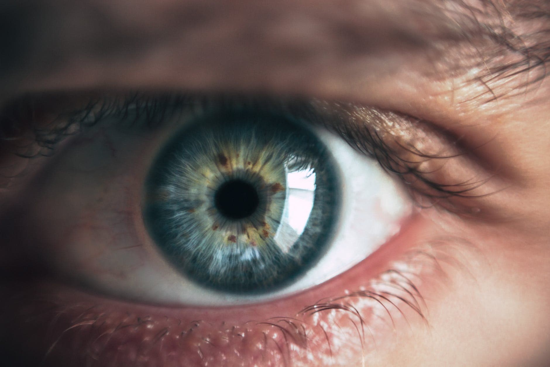 5 Tips to Help Prevent Cataracts