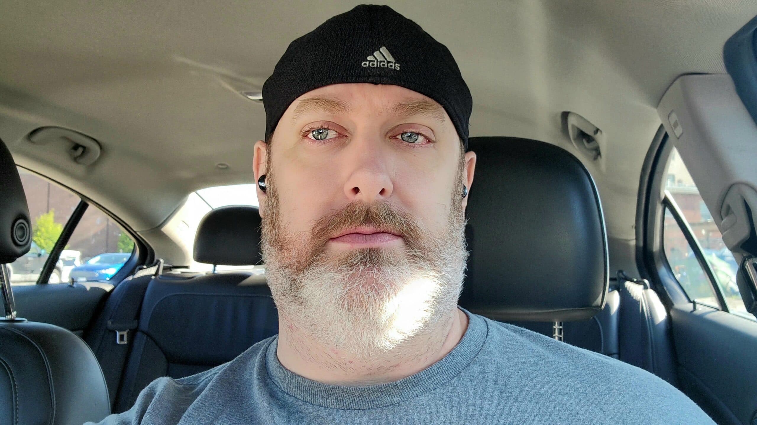 It's been 2 weeks since back surgery and here's how I'm doing