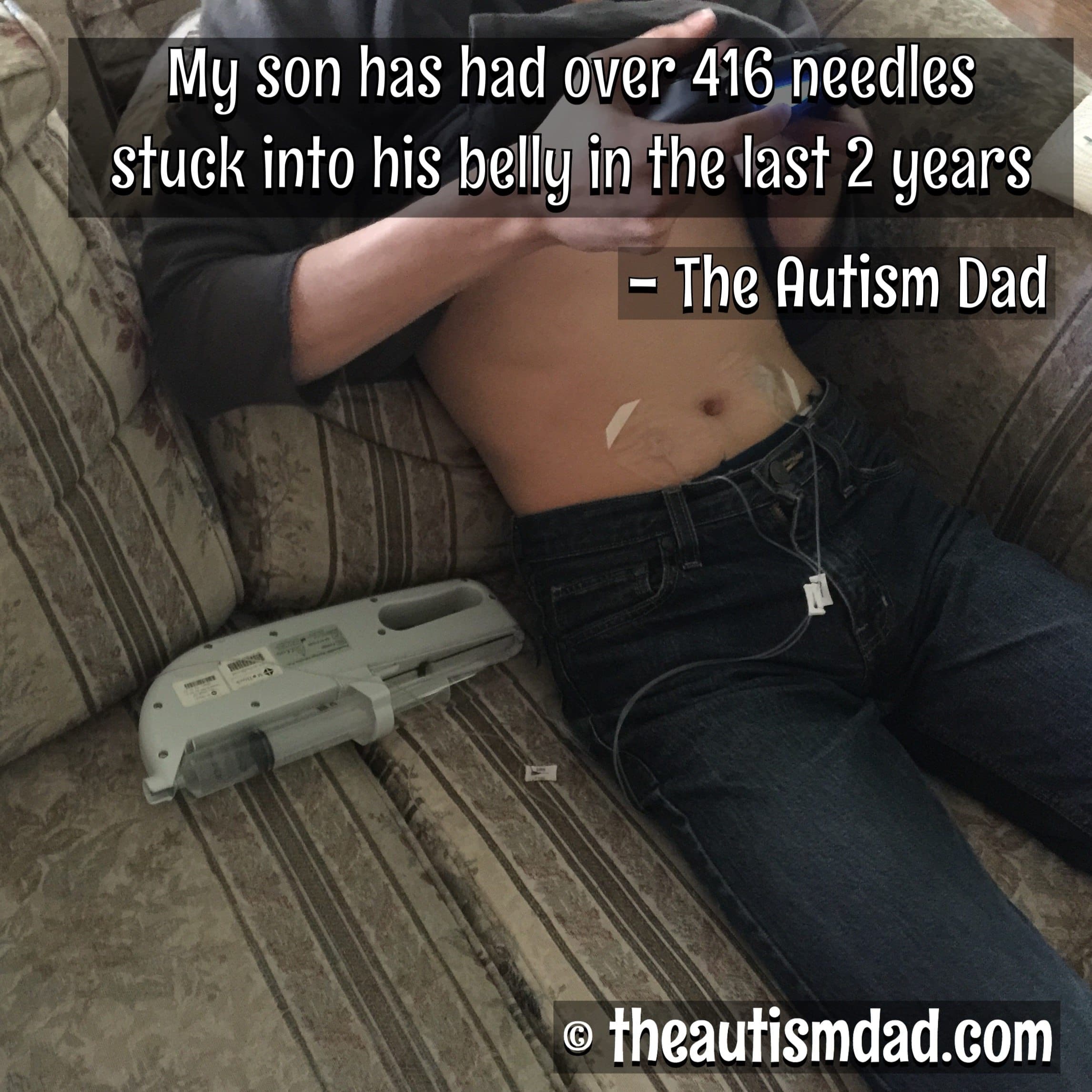 My son has had over 416 needles stuck into his belly in the last 2 years and never once complained