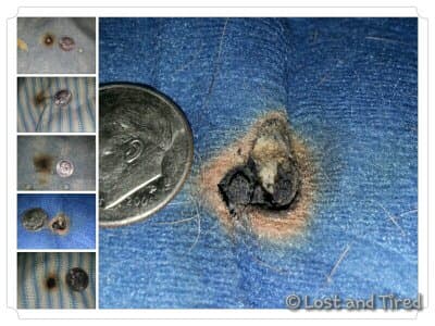 My Sunbeam heating pad caught fire while I was using it