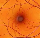 Operation Hope: Retuning to The Cole Eye Center