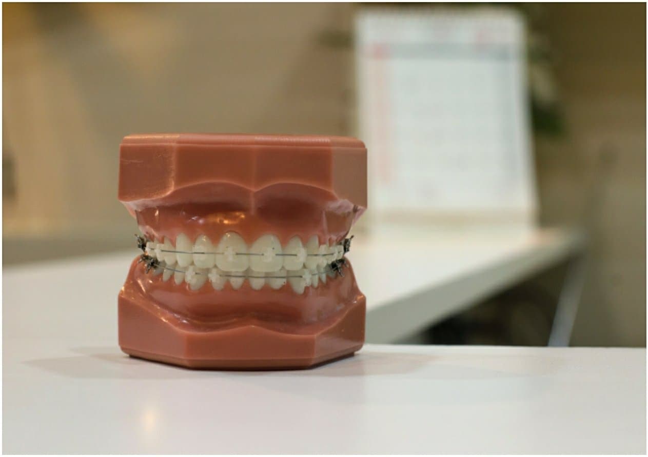 Teaching Your Kids Not To Be Afraid Of The Dentist