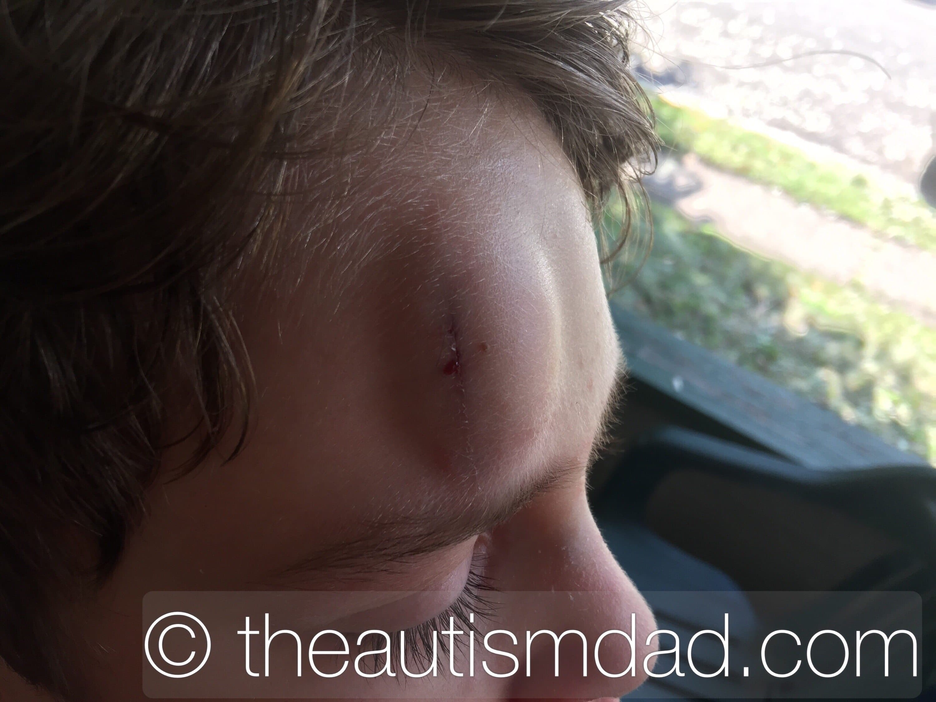 We had a really, really, really close call today