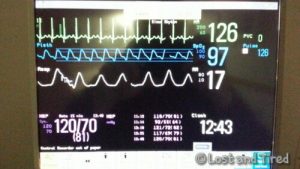 Read more about the article Autonomic Crisis: Stable-ish and home again