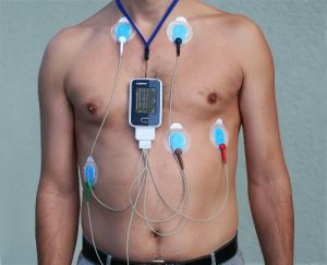 Read more about the article Operation Hope: Enter the Holter Monitor