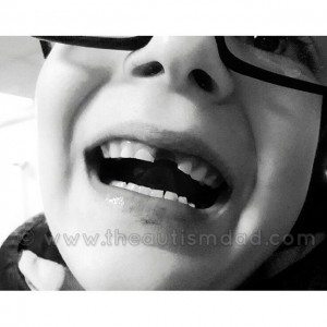 Read more about the article My tiny little Emmett lost his very first tooth today