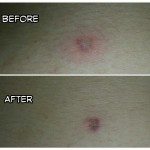 Gavin dealt with an infection this week