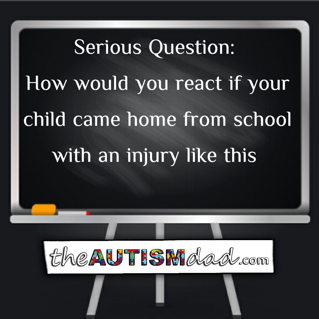 Read more about the article Serious Question: How would you react if your child came home from school with an injury like this 