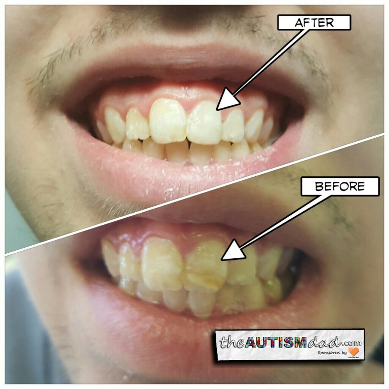 Here’s how Gavin’s trip to the dentist went